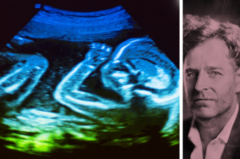 Embryo in der 20. Woche